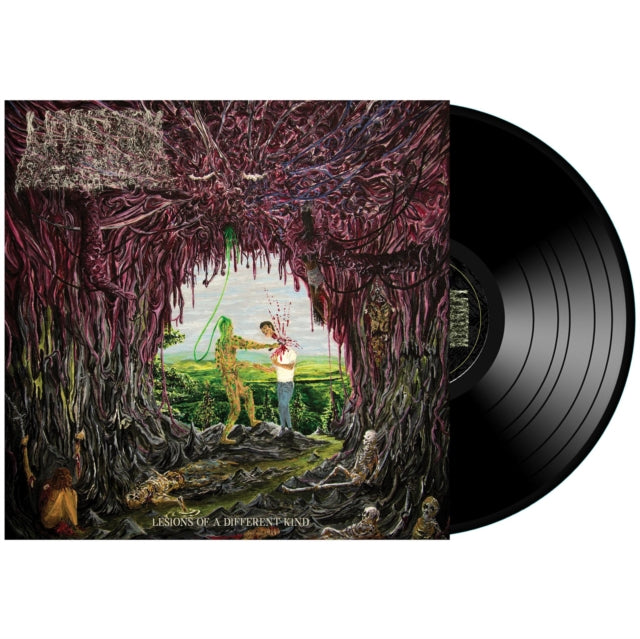 UNDEATH | LESIONS OF A DIFFERENT KIN | VINYL RECORD (LP)