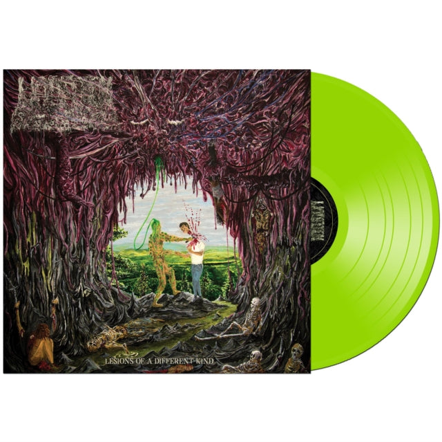 UNDEATH | LESIONS OF A DIFFERENT KIND (SLIME GREEN VINYL) | VINYL RECORD (LP)