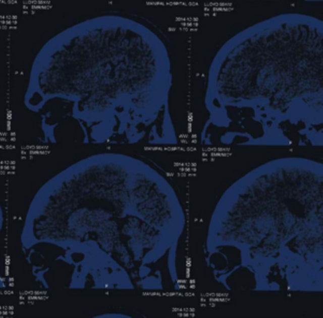 NIGHTINGALES | MIND OVER MATTER | VINYL RECORD (LP)