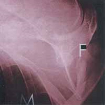 FATHER MURPHY | PAIN IS ON OUR SIDE NOW | 10IN VINYL