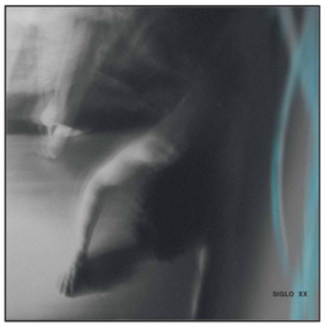 SIGLO XX | ANSWER | 12IN VINYL