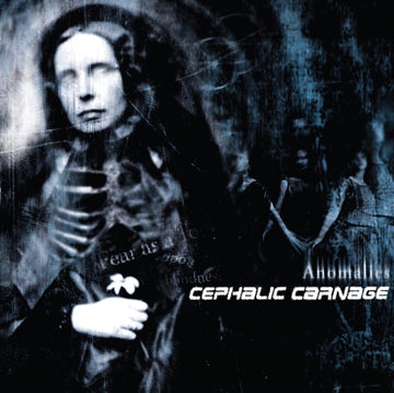 ANOMALIES (CUSTOM MARBLE VINYL) | VINYL RECORD (LP)