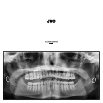 JVC (2LP) | VINYL RECORD (LP)