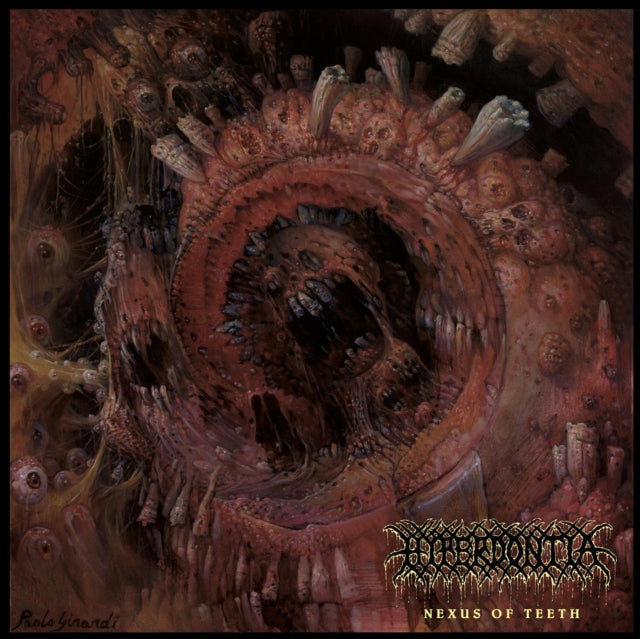 HYPERDONTIA | NEXUS OF TEETH | CD