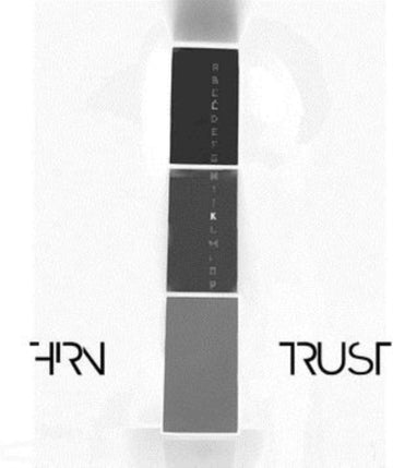 FIRN | TRUST | MUSIC CASSETTE