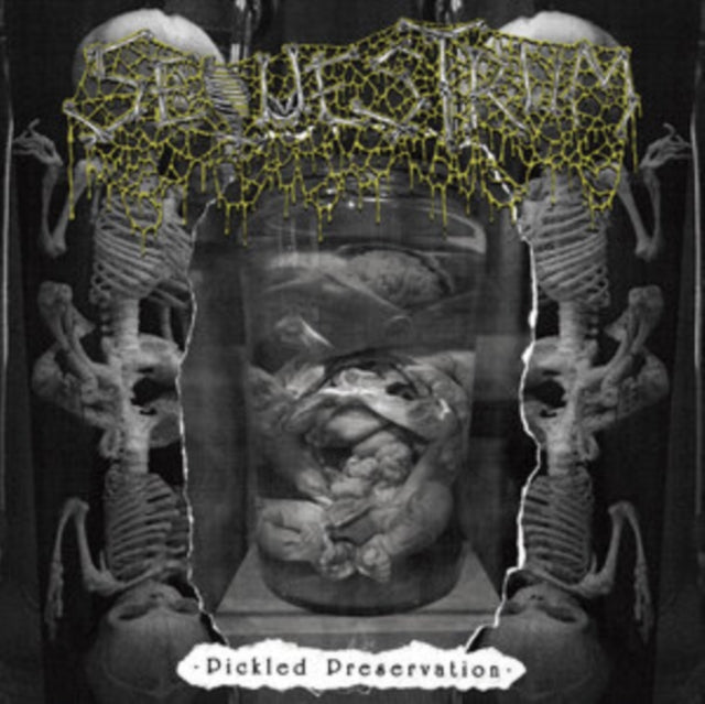 SEQUESTRUM | PICKLED PRESERVATION | MUSIC CASSETTE