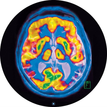 BRAINSCAN | 12IN VINYL